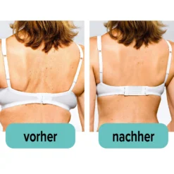 BH-Erweiterung 2 Haken weiß-schwarz-haut 6er-Set