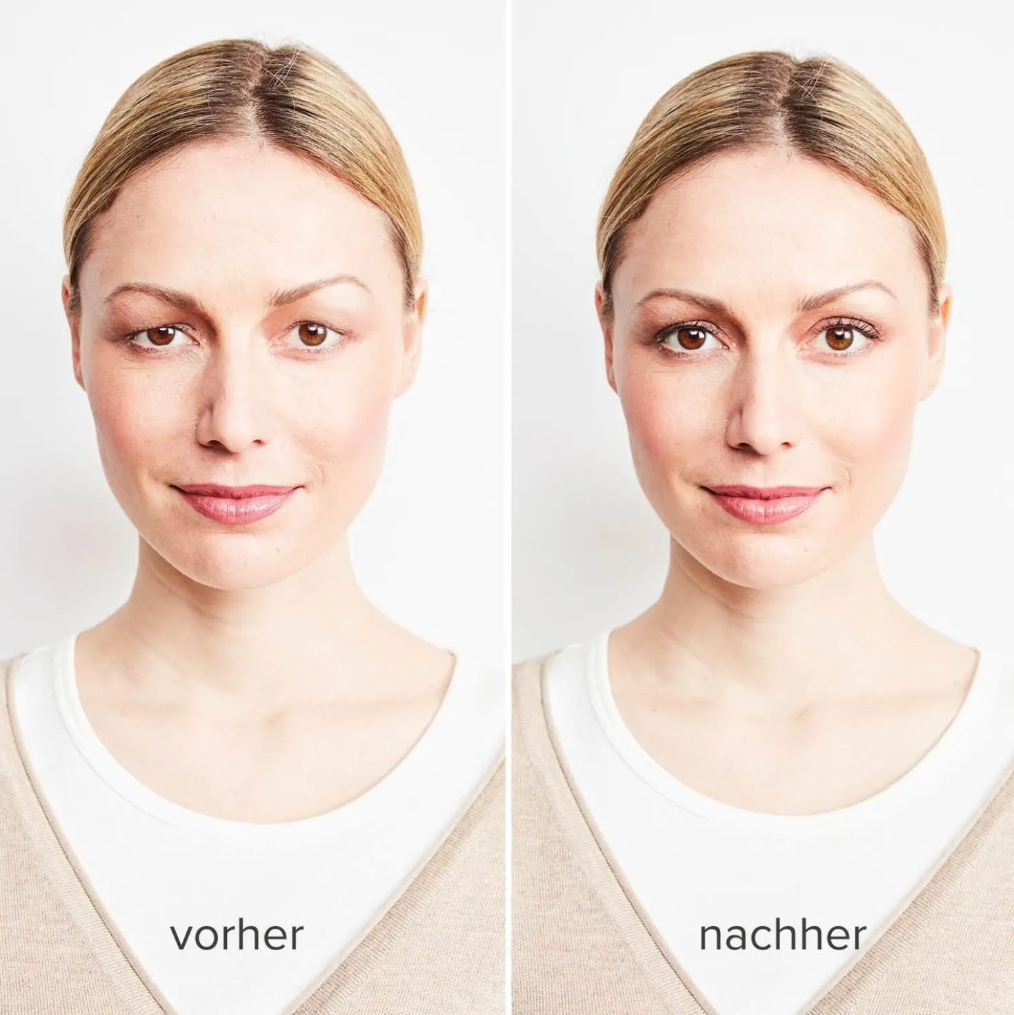 Lidstraffer unsichtbar, 240er-Set