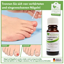 Nagelweichmacher